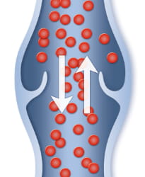 Beinvene mit Krampfadern